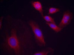 RelA/NFkB p65, p Ser536 Antibody, Novus Biologicals 25 &mu;L; Unconjugated:Antibodies,
